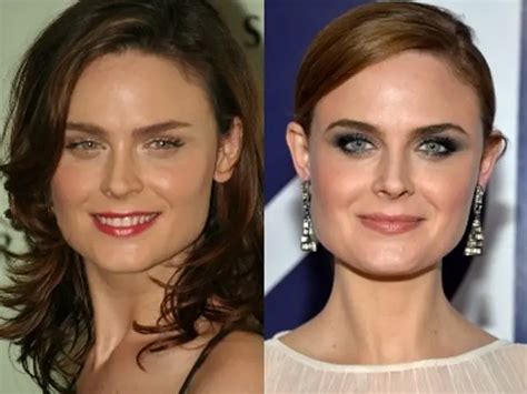 emily deschanel plastic surgery